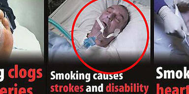 Schon wieder Wirbel um Mann auf der Tschickpackung