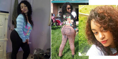 Pfusch-&Auml;rzte: Frau stirbt nach Po-Vergr&ouml;&szlig;erung