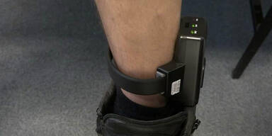 Software-Update legte Hunderte Fu&szlig;fesseln lahm