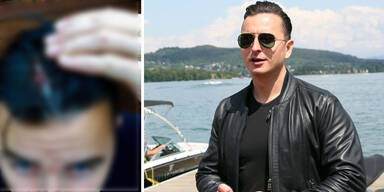 Andras Gabalier Platzwunde