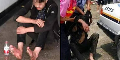 F&uuml;&szlig;e von Dauer-Gamer begannen zu faulen