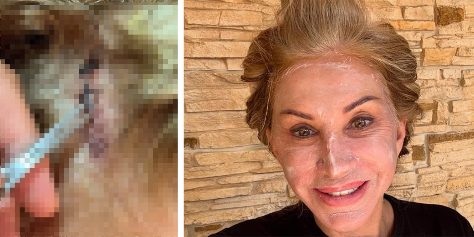 Carmen Geiss zeigt Fans Horror-Narbe: "Achtung, das ist nicht für jeden  was!" - stars24