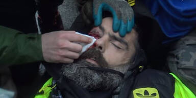 Gelbwesten-Aktivist nach Polizei-Einsatz in k&uuml;nstlichem Koma