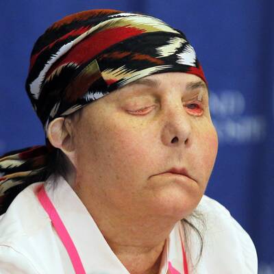 Neues Gesicht für Laugen-Opfer