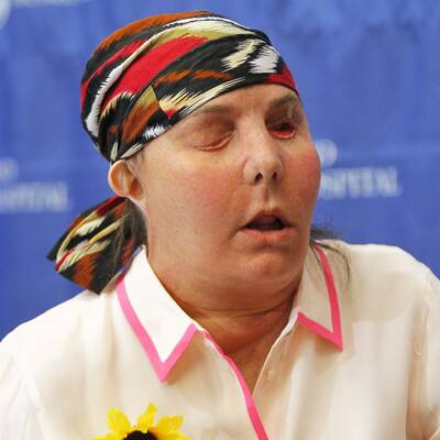 Neues Gesicht für Laugen-Opfer