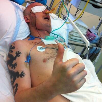 Gesichtstransplantation in Polen