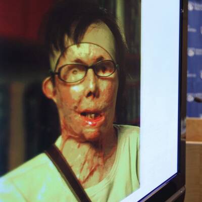 Neues Gesicht für Laugen-Opfer