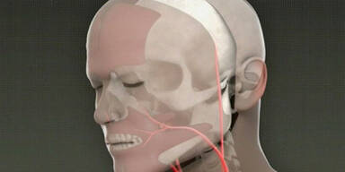 Komplettes Gesicht transplantiert