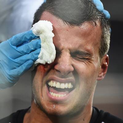 Hier kracht Newcastle-Star gegen Stange