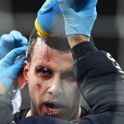 Hier kracht Newcastle-Star gegen Stange