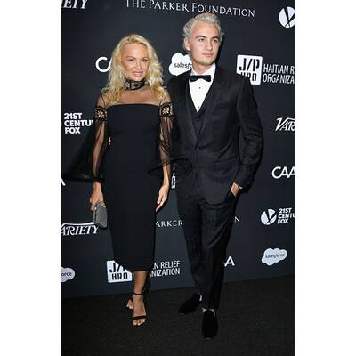 Pamela Anderson: Frisch operiert