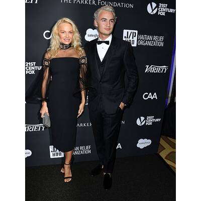 Pamela Anderson: Frisch operiert