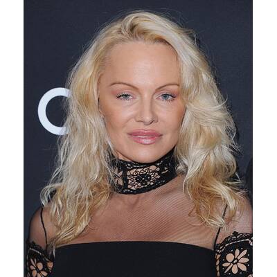 Pamela Anderson: Frisch operiert