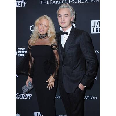 Pamela Anderson: Frisch operiert