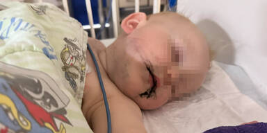 Eltern warnen vor Giftpilzen aus Blumentöpfen