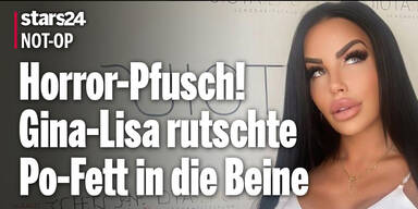Horror-Pfusch! Gina-Lisa rutschte Po-Fett in die Beine