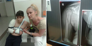 &Auml;rzte schicken schwer verletzten Bub heim