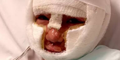 Verletzter Bub Mobbing