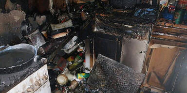 Grazerin bei Brand lebensgef&auml;hrlich verletzt