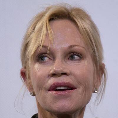 Wer hat Hollywoods schlimmste OP-Fratze?