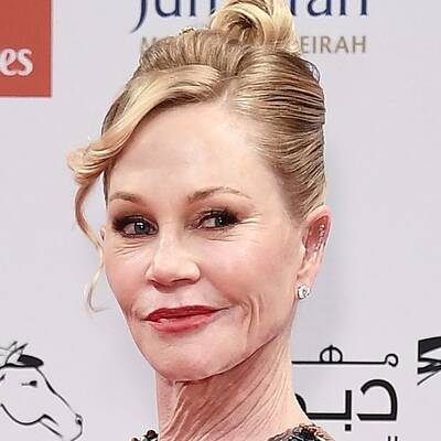 Melanie Griffith: Botox-Überdosis
