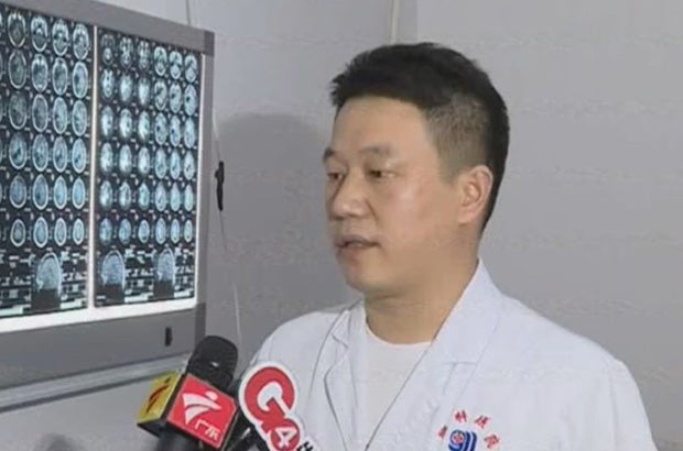 Chinese hatte 15 Jahre lang Bandwurm im Gehirn