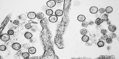 Nach Covid-19: Neues Virus breitet sich in China aus