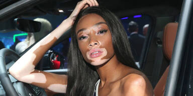 Winnie Harlow