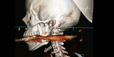 Elisangela Borborema Rosa Harpune Röntgen