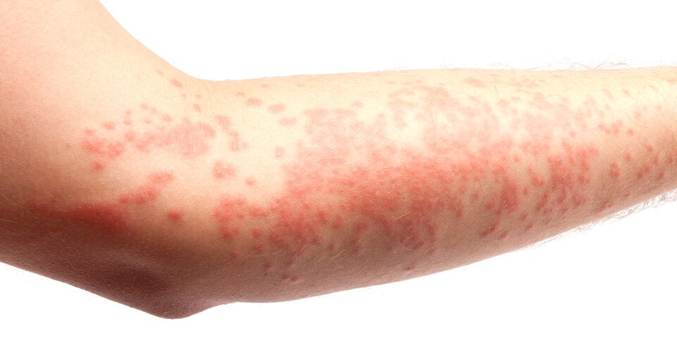 Studie: Das sind die frühesten Corona-Symptome