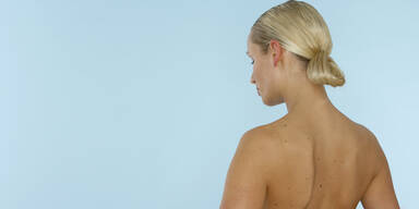 Mit diesem Ger&auml;t k&ouml;nnte in Zukunft Hautkrebs erkannt werden