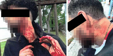 Glasscherben Attacke Traiskirchen