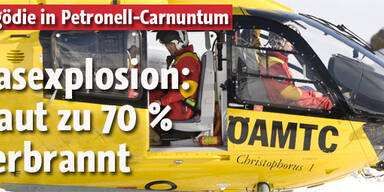 Schwerste Verbrennungen nach Gasexplosion