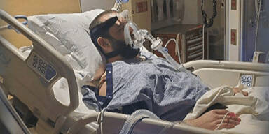 US-Krankenhaus streicht Ungeimpften von Transplantations-Liste