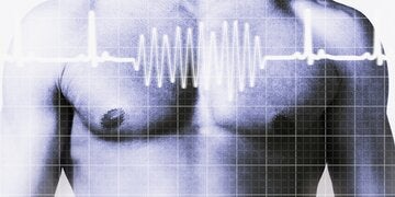 Herzrhythmus
