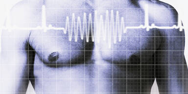 Herzrhythmus