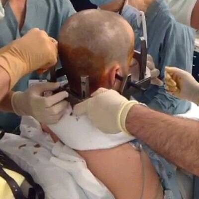 Patient spielt während Hirn-OP Gitarre