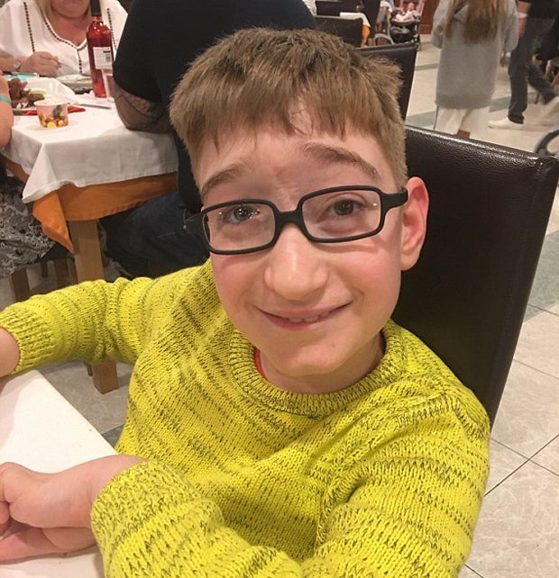 Baby mit Hirn am Gesicht geboren