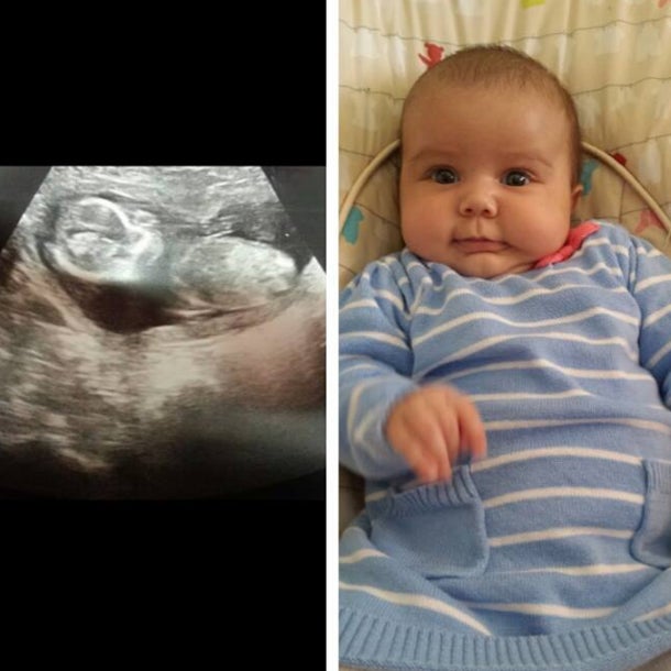 Michelle Hui Facebook