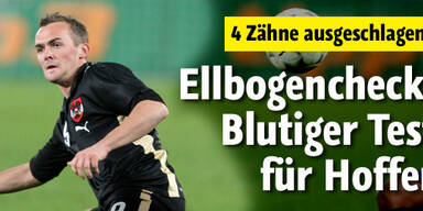 Hoffer verliert vier Zähne