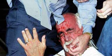 Hulk Hogan blutig geschlagen