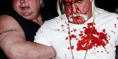 Hulk Hogan blutig geschlagen