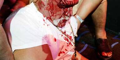 Hulk Hogan blutig geschlagen