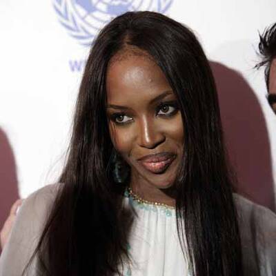 Ungeliebte Hotelgäste: Axl Rose