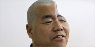 Mann bekommt neuen Kopf aus 3D-Drucker