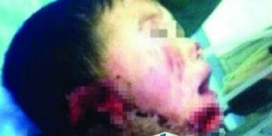 Chinesin schnitt Neffem beide Ohren ab