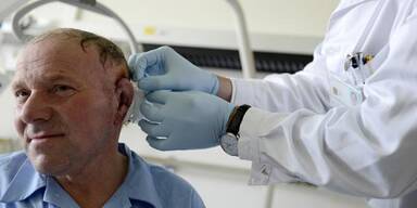 Hundebiss-Opfer bekam neues Ohr 