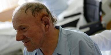 Hundebiss-Opfer bekam neues Ohr 