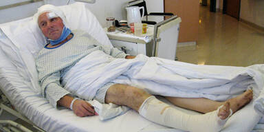 Opfer von Hunde-Attacke in Freistadt