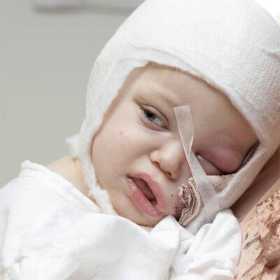 Benet (2) von Hund gebissen